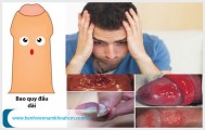 Bao quy đầu dài có sao không? Chữa trị bằng phương pháp nào?