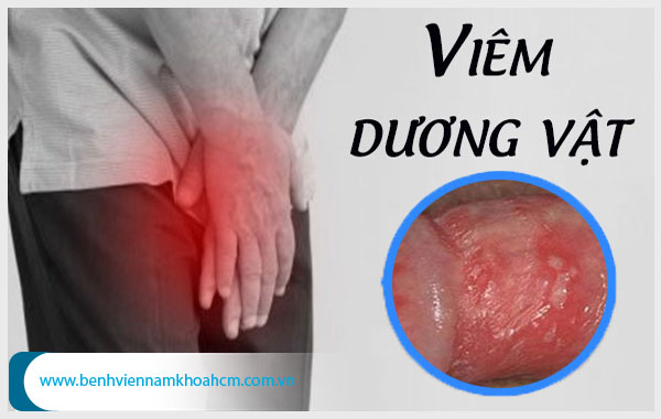 Các bệnh về bao quy đầu có thể dẫn đến viêm nhiễm dương vật