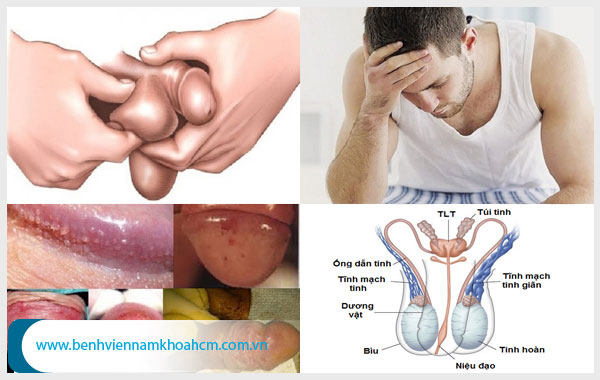 Tinh trùng trong suốt và những bệnh lý liên quan