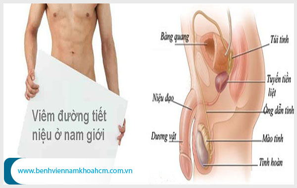 Cần sớm chữa trị viêm đường tiết niệu