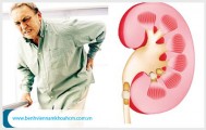 Chứng bệnh viêm đường tiết niệu có lây không ?